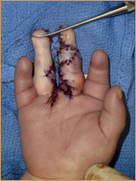 Dr. Enna’s Hand and Microsurgery